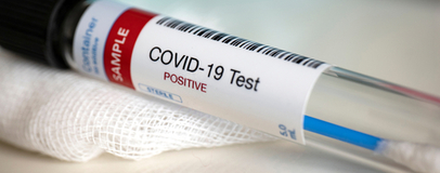 Алгоритм дій у разі отримання позитивного тесту на COVID-19